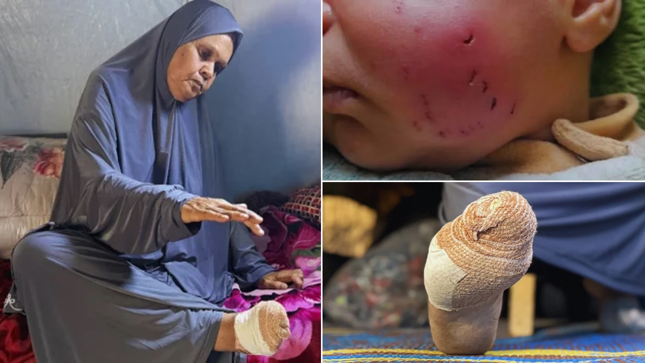 গাজার আশ্রয়শিবিরে নতুন আতঙ্ক, ঘুমন্ত মুসলিমদের শরীর কামড়ে খাচ্ছে ইঁদুর