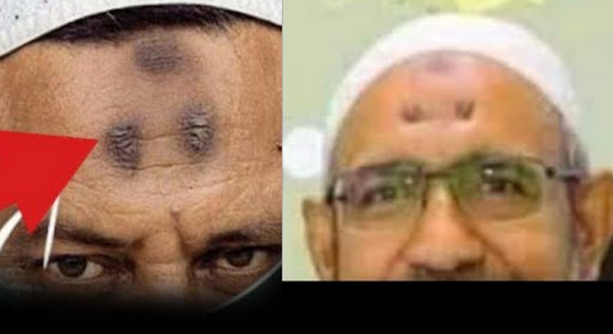 নামাজের মর্যাদা ও কপালের দাগের গোপন বাস্তবতা