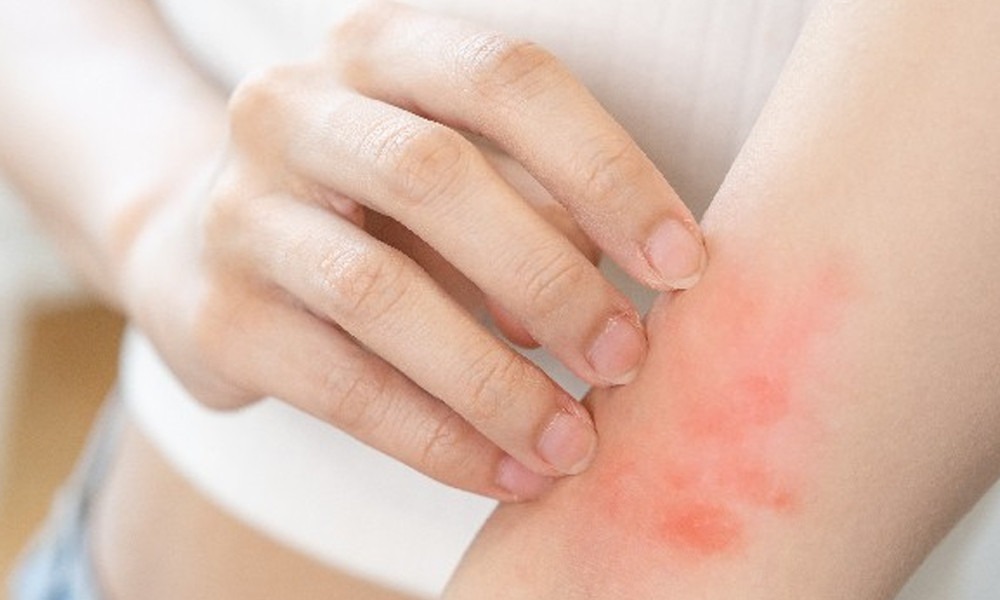 শীতে ত্বকের চুলকানি? সহজ কিছু অভ্যাসেই মিলবে আরাম