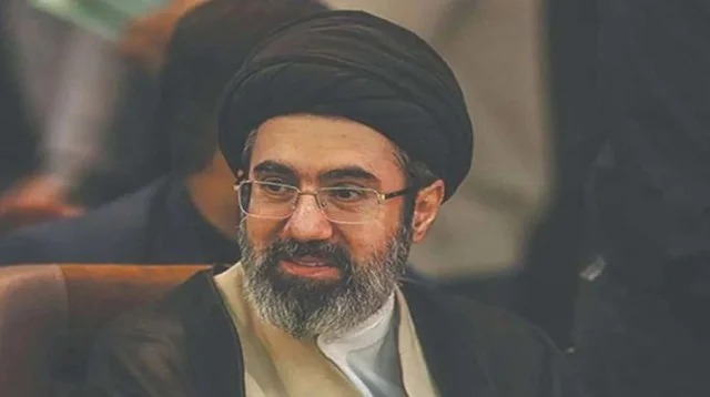 আঘাতজনিত কারনে মোজতবা খামেনির মুখ বিকৃতি হয়েছে