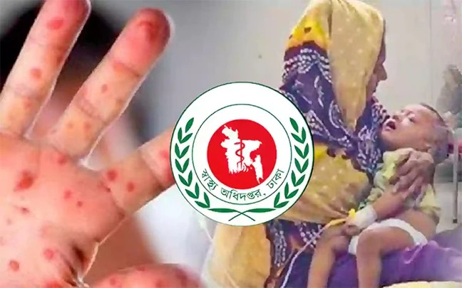 হামে ২৪ ঘণ্টায় ৯ শিশুর মৃত্যু ও নতুন ১,১০৫ জন শনাক্ত